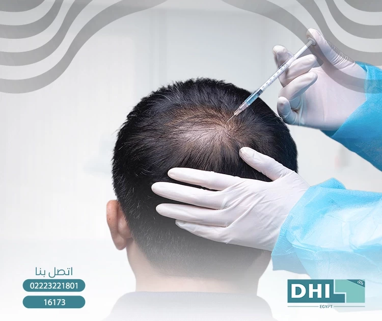 Egypt's specialized hair transplant clinics - DHI is the best