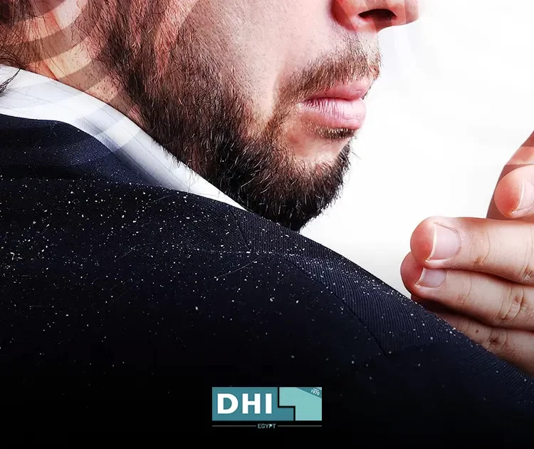 Scabs following hair transplantation| How they look