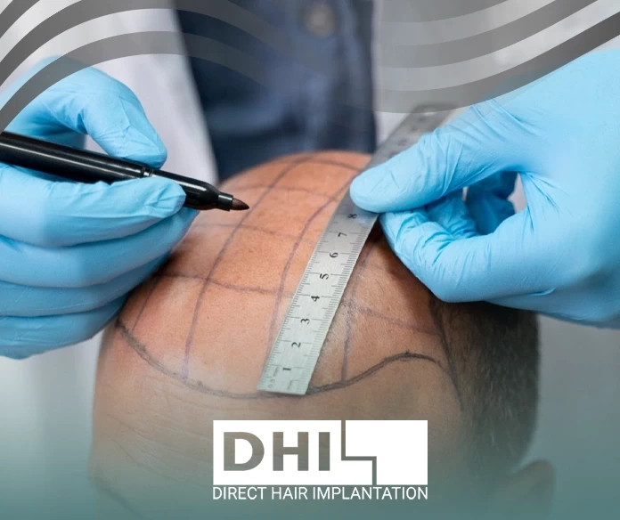 Signs of hair transplant success