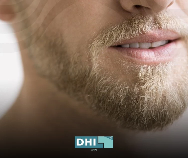 Chin implant before and after
