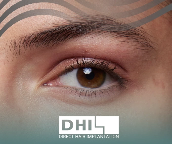 Causes of eyebrow hair loss
