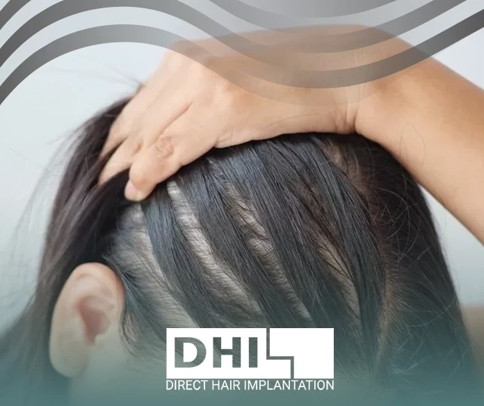 My experience with hair spaces