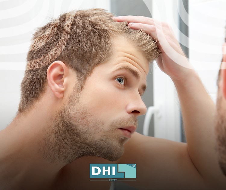 Hair loss after transplantation Is it normal?