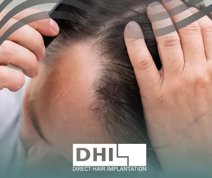 Treating hereditary baldness