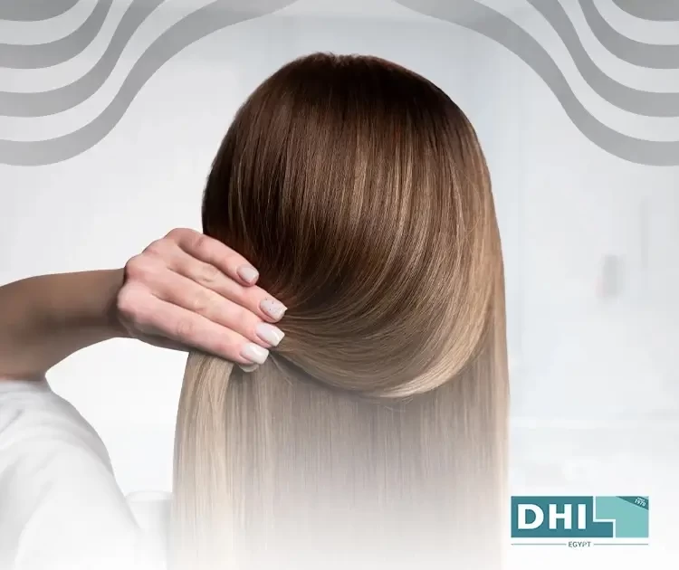 How to transplant hair for women