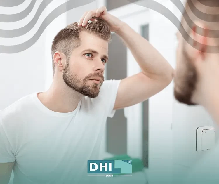 Can transplanted hair fall?