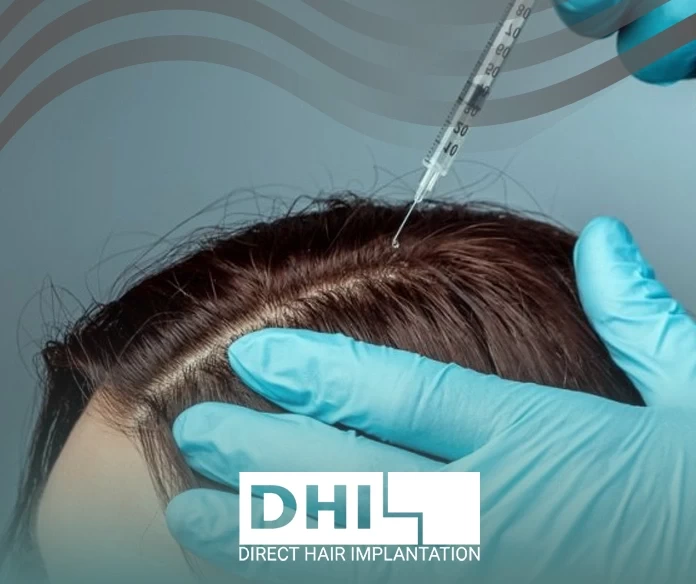 Hair transplantation with stem cells