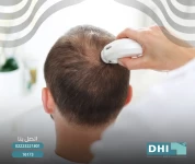 Hair Loss Diagnosis